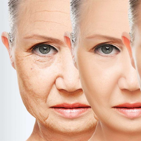 Anti Aging