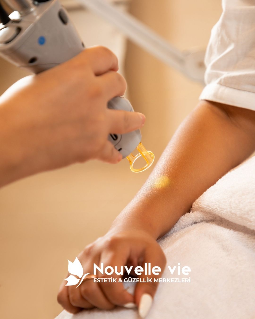 Lazer Epilasyon Nedir?